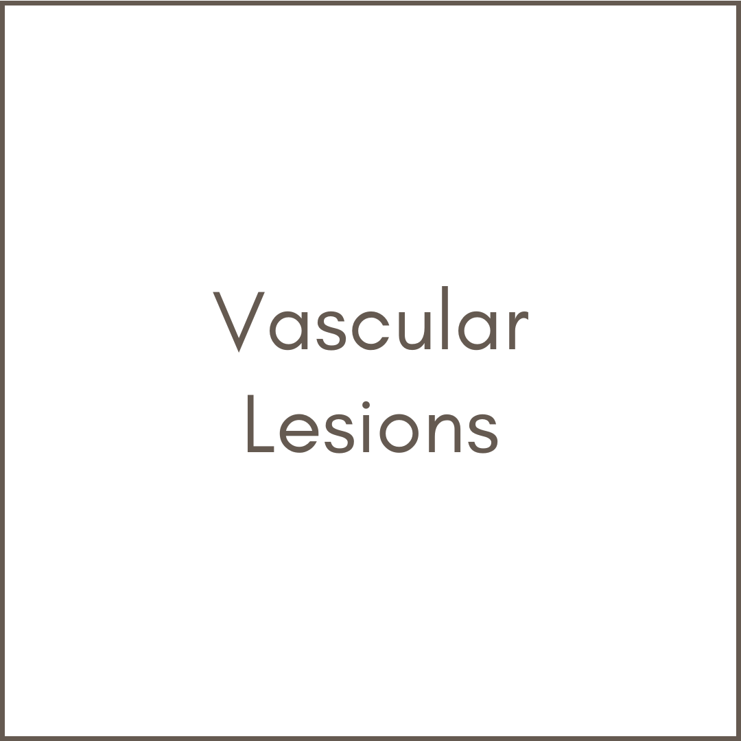 Vascular Lesions