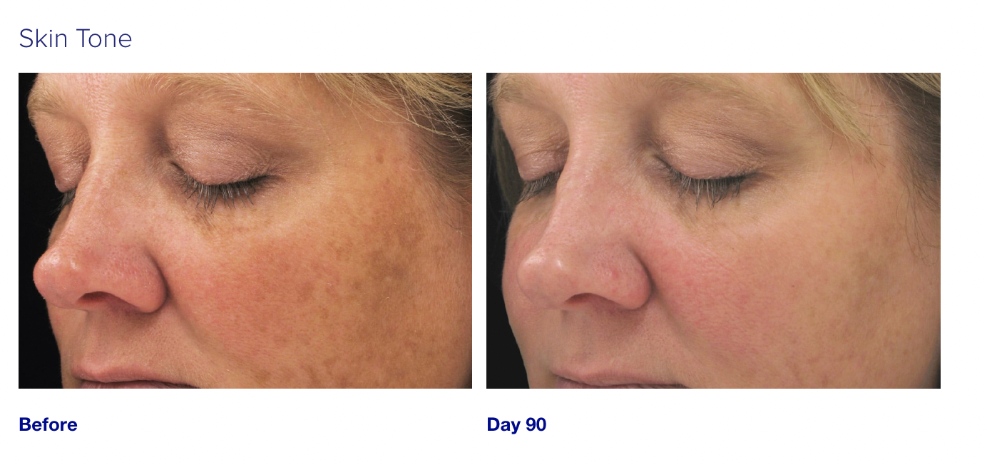Brightening Complex