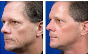 iS Clinical Poly-Vitamin Serum