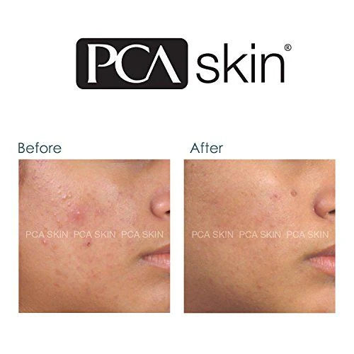 Blemish Control Bar